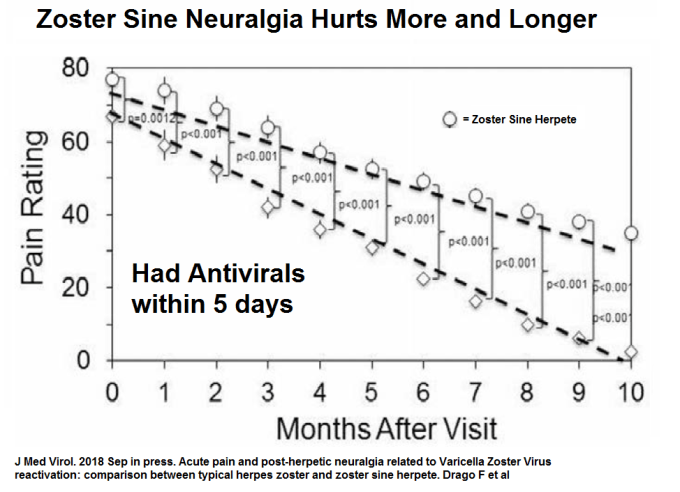 sine neuralgia worst