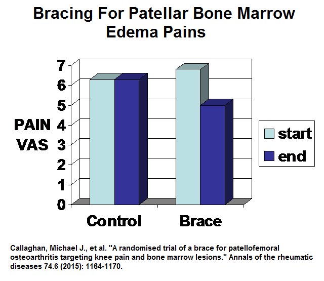 bracing_bme_patella