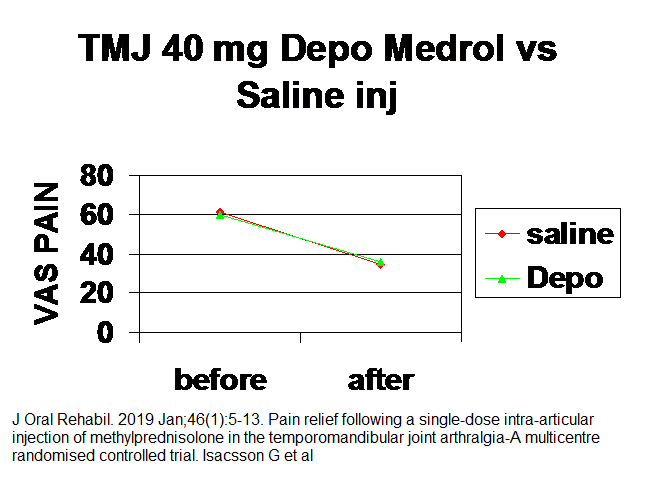 tmj_steroid_inj