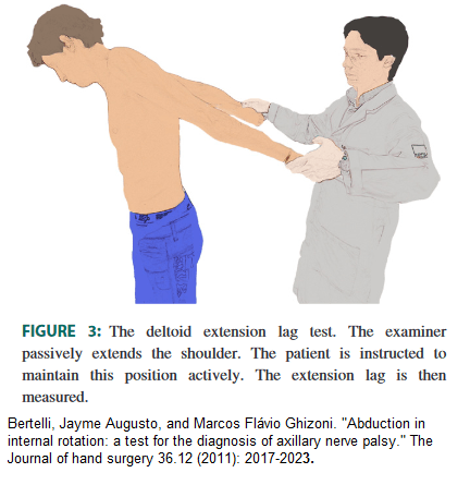 deltoid extension test
